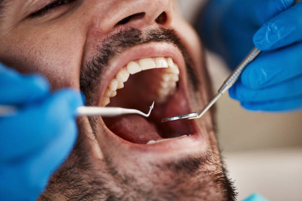 Best Emergency Dental Care for Broken or Chipped Teeth in Malvern, OH