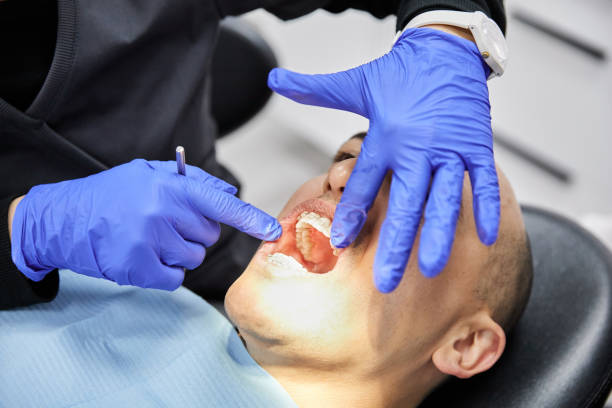 Best Emergency Dental Care for Broken or Chipped Teeth in Malvern, OH